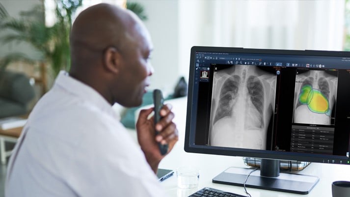 Chest X-ray AI: Taking on detection and diagnosis challenges in chest X-rays