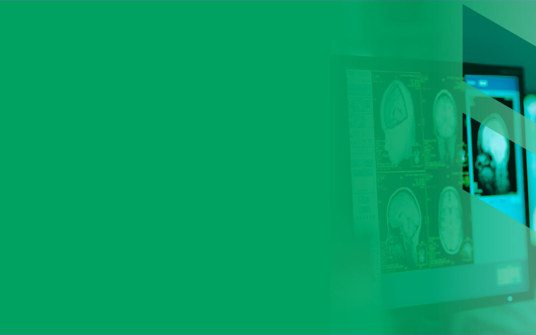 CEUS as an asset to improve workflow of patients with focal liver lesions