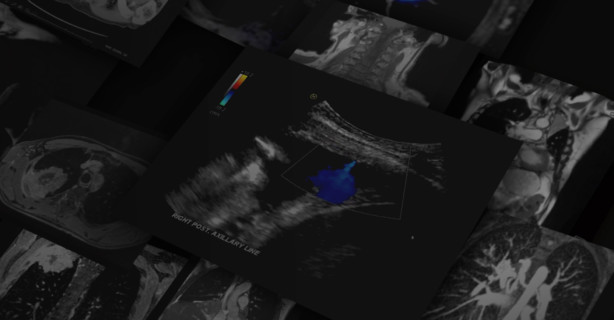 Chest Imaging: Ultrasound